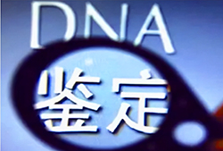 大同上户DNA鉴定要如何做